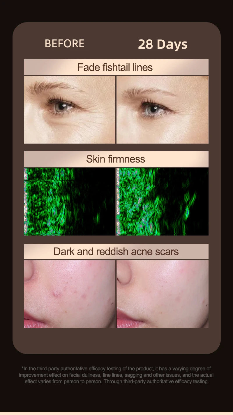 Photon Rejuvenation LED Mask Household Beauty  Red Light Face and Neck beauty equipment