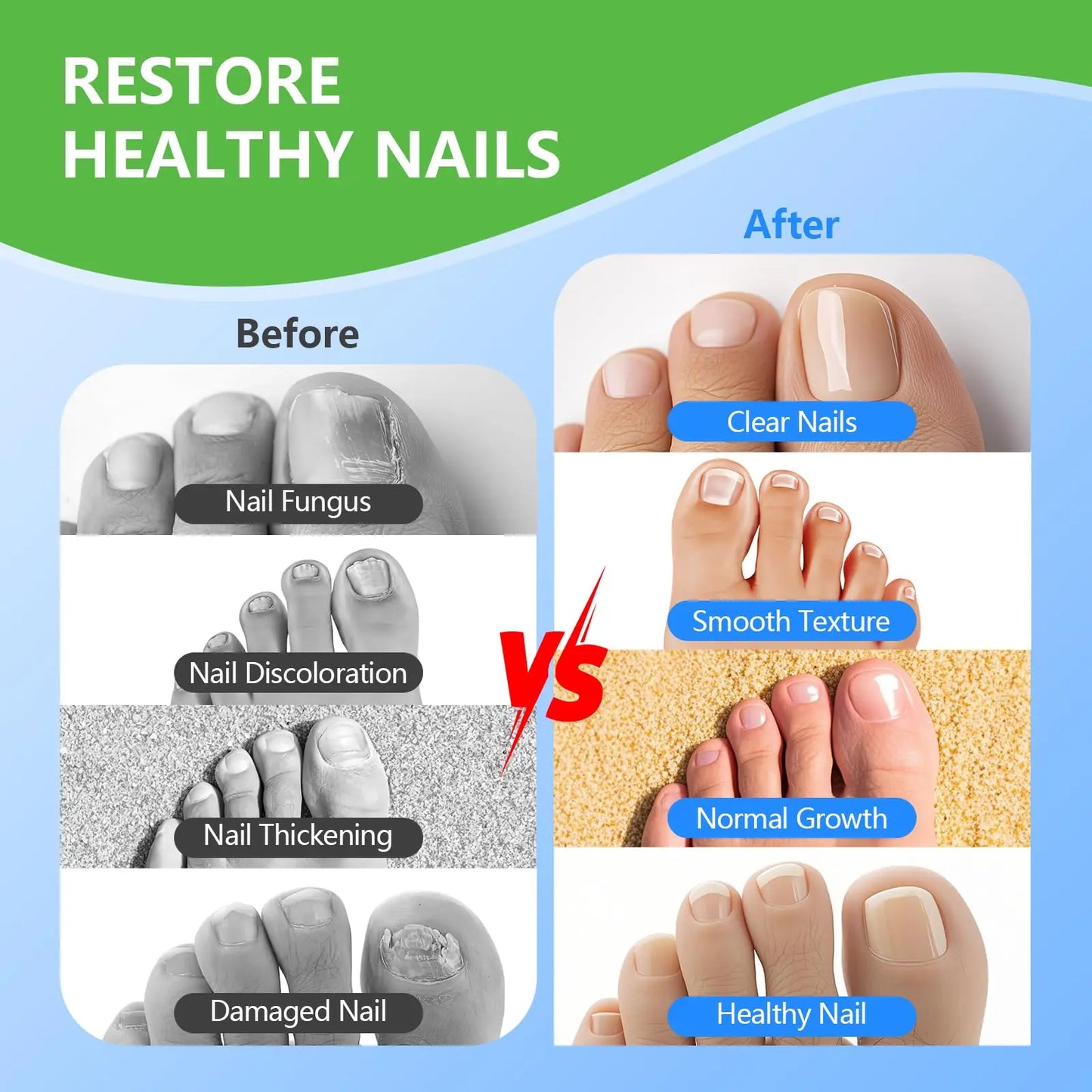 Laser Device for Mycosis Nails 15x470 nm Blue Light&30x650 nm Red Light for Nail Fungus Treatment Digital Display Nail Care