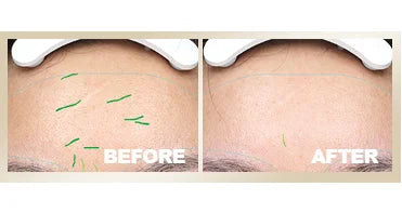 Face Massage Wrinkle Remover Device Facial EMS Machine Skin Microcurrent Red Light Therapy Instrument Home Use Beauty Equipment