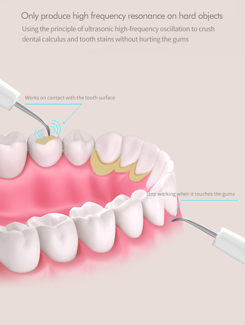 Electric Sonic Dental Calculus Scaler Oral Teeth Tartar Remover Plaque Stains Cleaner Removal Tooth Whitening Portable with LED