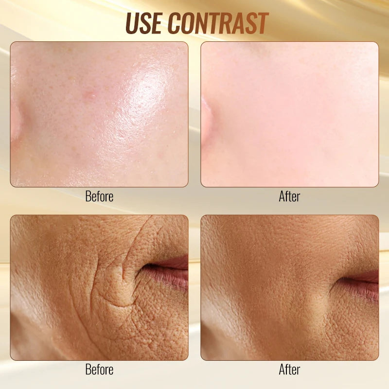 High frequency facial cleansing and blemish control device professional beauty equipment for home use the effect is very good